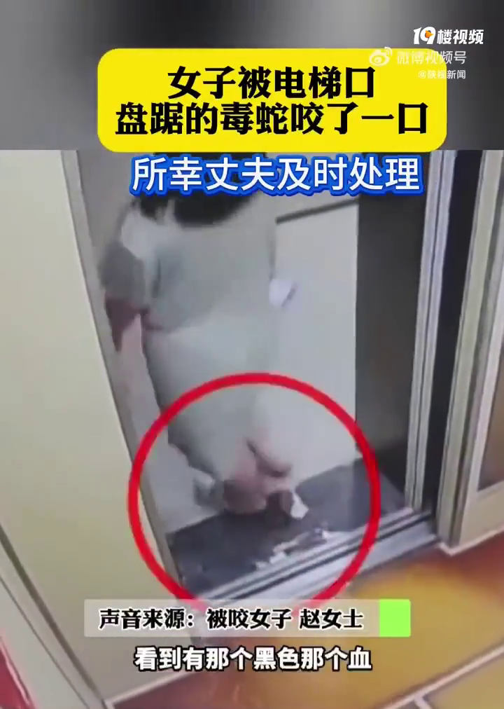 女子电梯口被毒蛇咬老公教科书式操作