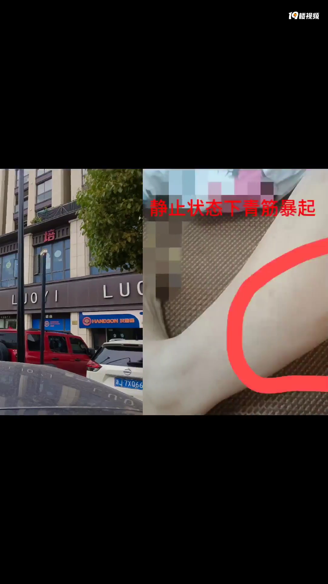 ��2.5��ȥ����ҽԺ��֬��С�ȣ����......